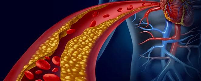 Has the Cholesterol Test Outlived its Usefulness?
